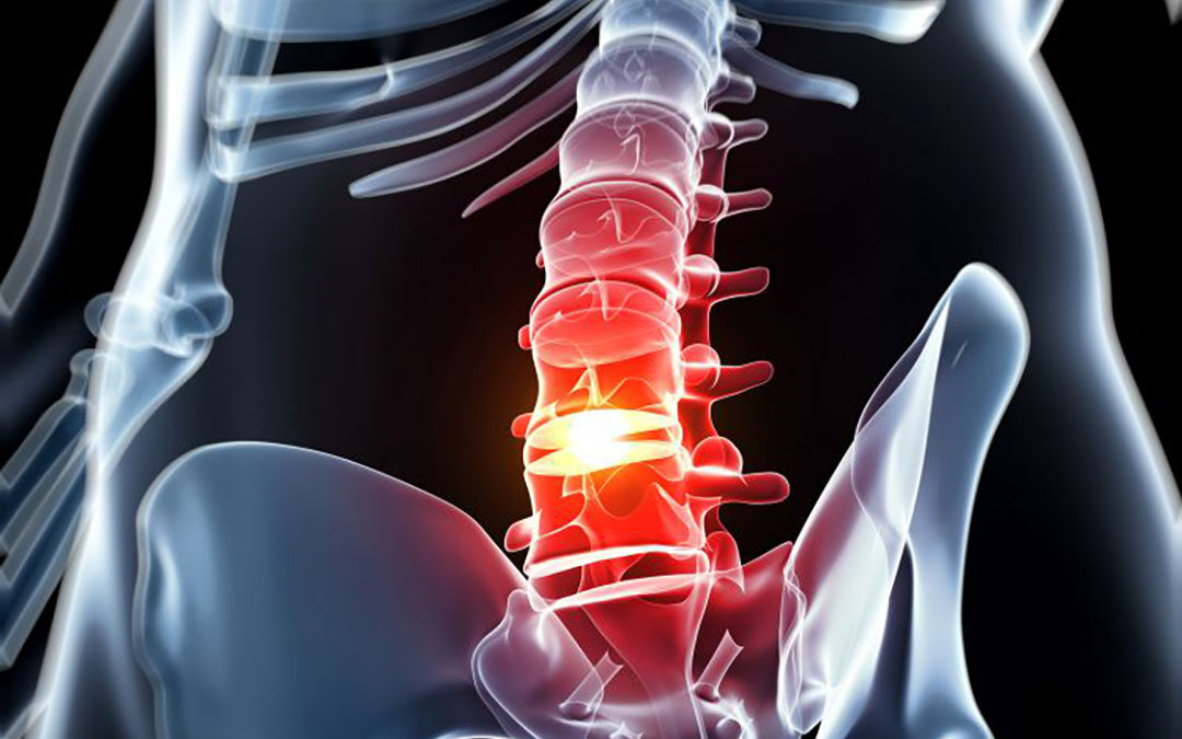 Vertebre lombari: cosa sono, funzioni e caratteristiche