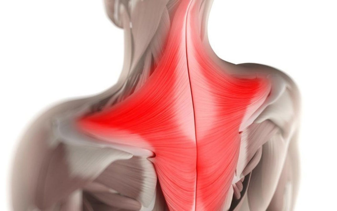 Muscolo Trapezio: Anatomia, Funzioni, Dolore, Cause, Rimedi